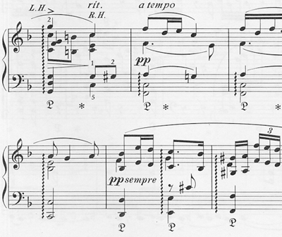 Grieg - Lyric Pieces Op 43 | ΚΑΠΠΑΚΟΣ